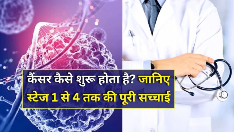 Stages of cancer explained