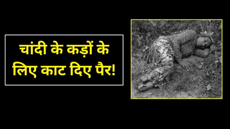 Elderly woman legs cut