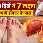 liver damage symptoms in feet