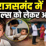 Rajsamand measles case news