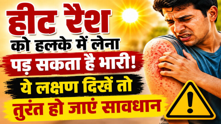 Heat rash treatment