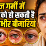 Heatwave Eye Problems